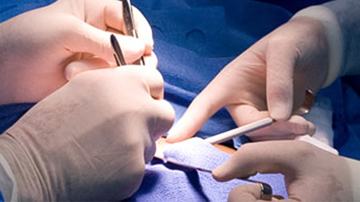 General Surgery service image of male doctor operating at rome health hospital near rome ny